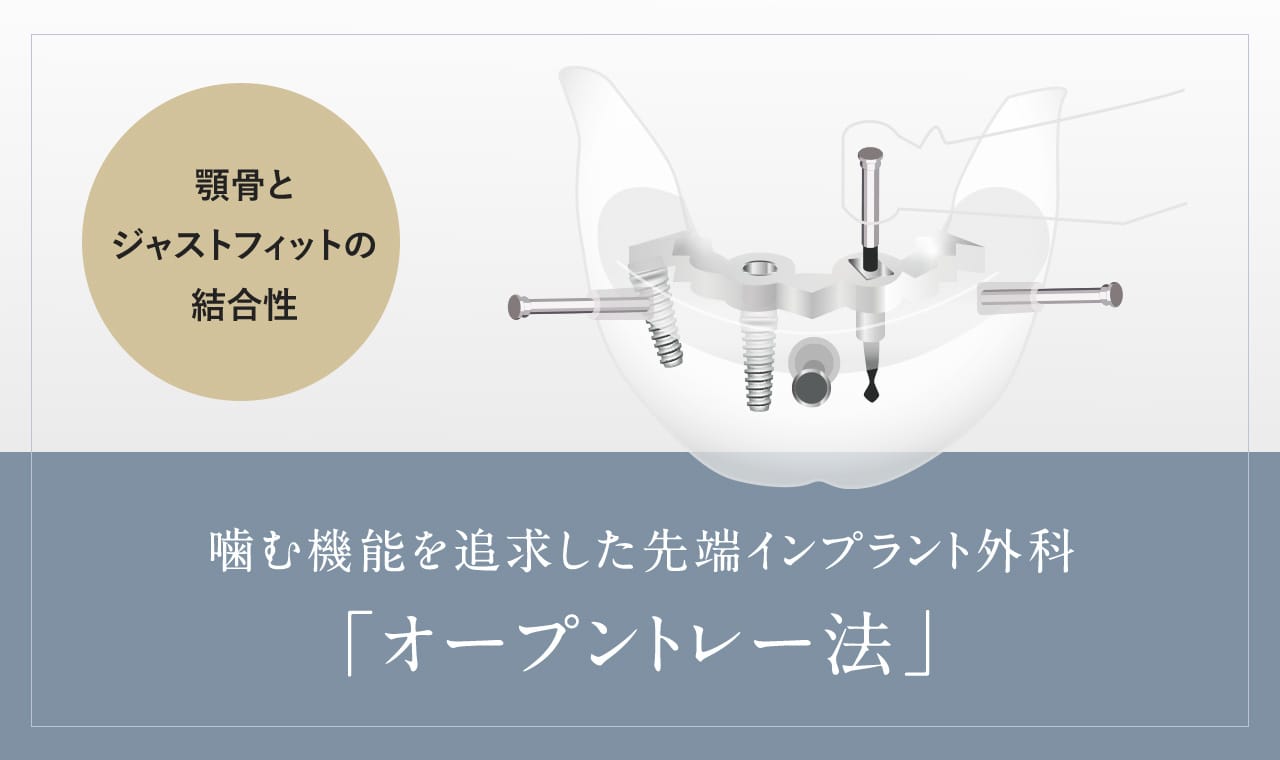 噛む機能を追求した先端インプラント外科「オープントレー法」