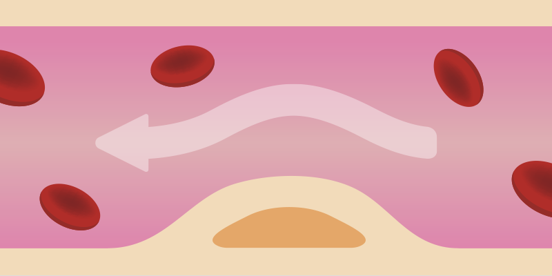 赤黒いドロドロ血液